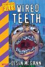 Wired Teeth - Preview