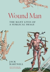 Capa do artigo Wound Man