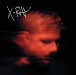 Capa do artigo X-Ray - CD